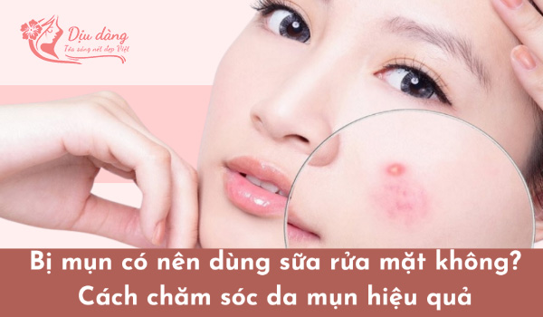 bi-mun-co-nen-dung-sua-rua-mat-khong