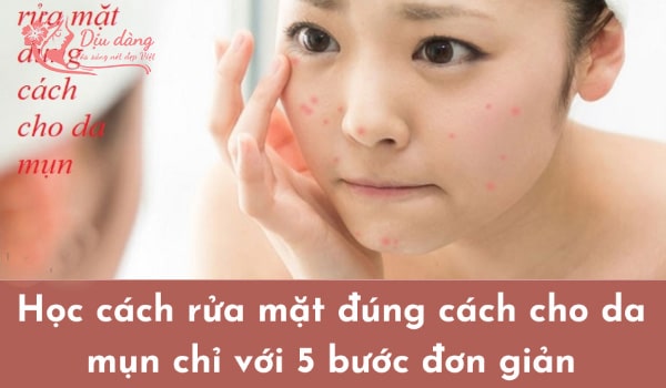 huong-dan-rua-mat-dung-cach-cho-da-dau-mun