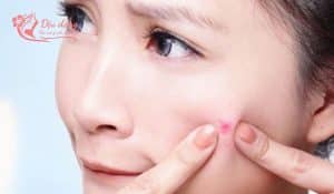 tai-sao-cang-skin-care-lai-cang-noi-mun-an