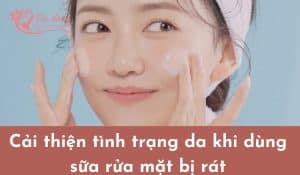 nguyen-nhan-dung-sua-rua-mat-bi-rat-da