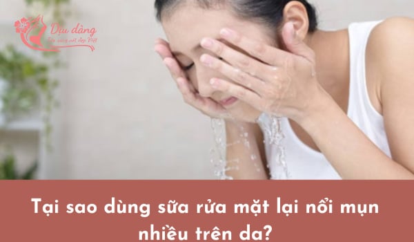 tai-sao-dung-sua-rua-mat-lai-noi-mun