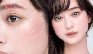 cach-danh-ma-hong-cho-nguoi-mat-tron