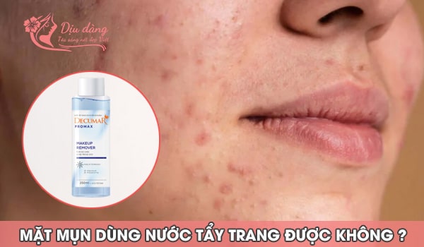 mat-mun-dung-nuoc-tay-trang-duoc-khong
